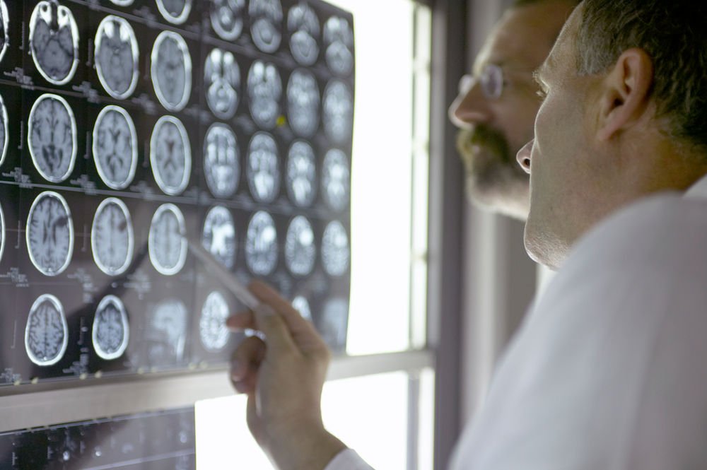 Neuro psychiatrist surguja clinic