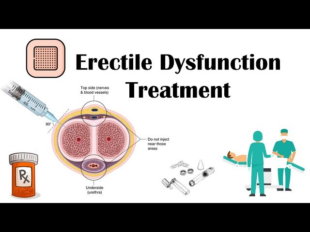 Erectile dysfunction treatment in surguja